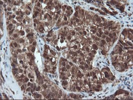 PSMA6 Antibody (clone OTI7C2)