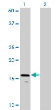 IHC-plus™ Monoclonal Mouse anti-Human AGTRAP / ATRAP Antibody (clone 1G2, IHC, WB)