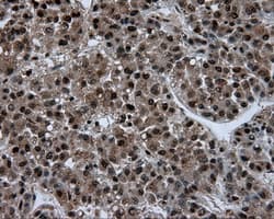 Monoclonal Mouse anti-Human ACLY / ATP Citrate Lyase Antibody (clone 3G8, Carrier-free, IHC, IF, WB)