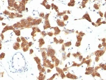 KRT18 / CK18 / Cytokeratin 18 Antibody (clone B23.1)
