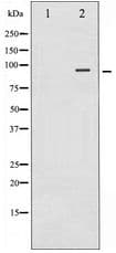 Polyclonal Rabbit anti-Human NTRK2 / TRKB Antibody (IHC, WB)