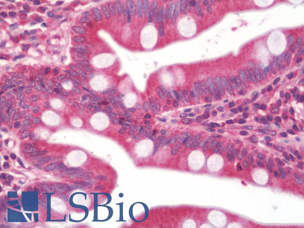 IHC-plus™ Polyclonal Rabbit anti-Human HRAS / H-Ras Antibody (aa111-189, IHC, WB)