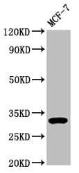 DKK2 Antibody (aa34-259)