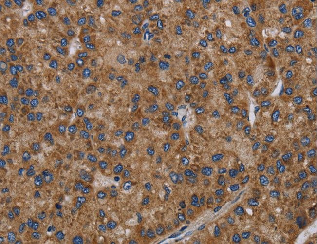PVRL2 / CD112 Antibody