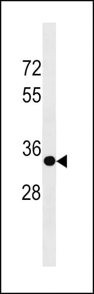 Polyclonal Rabbit anti-Human SPRY3 / Sprouty 3 Antibody (aa261-288, WB)