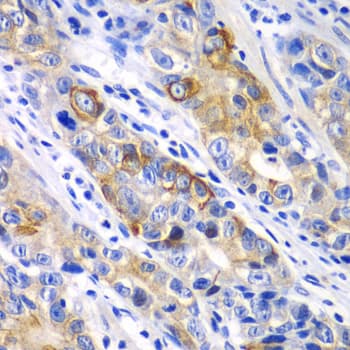 BCL2 / Bcl-2 Antibody