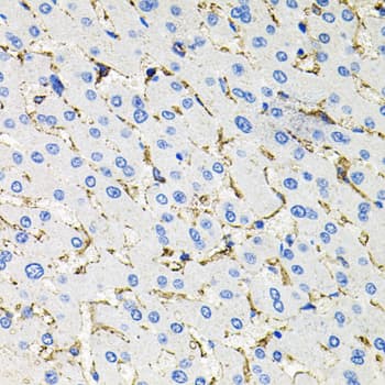 Polyclonal Rabbit anti-Human SSTR2 Antibody (IHC, WB)
