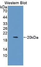 IL-1B / IL-1 Beta Antibody