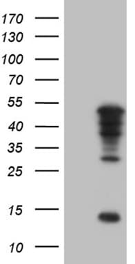 TBX20 Antibody (aa1-340, clone OTI6C9)
