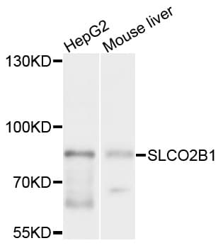 SLCO2B1 Antibody