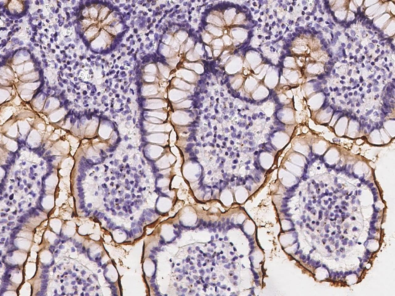 SLC5A1 / SGLT1 Antibody
