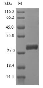 Plasmodium falciparum AMA-1 Protein (Recombinant 6His, N-terminus)