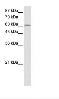 PRMT5 Antibody (aa21-70, Biotin)