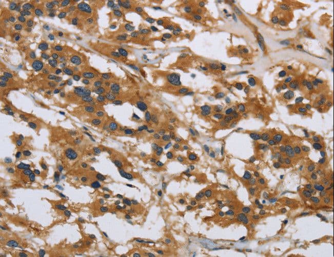 IL5RA / CD125 Antibody