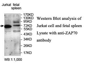 Polyclonal Rabbit anti-Human ZAP70 Antibody (aa168-421, WB)