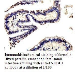 ZFAND4 / ANUBL1 Antibody (aa453-653)