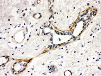 YES1 / c-Yes Antibody
