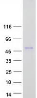 Human ALX3 Protein (Recombinant Myc-DDK (Flag))