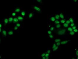PGAM2 Antibody (clone OTI2F5)