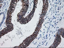 ALDH3A2 Antibody (clone OTI2A7)