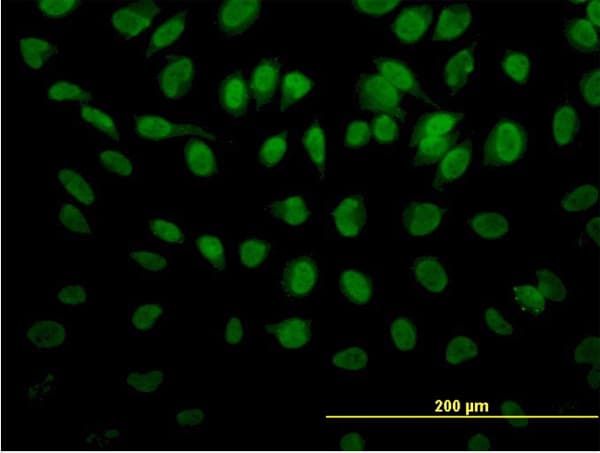 PTBP3 / ROD1 Antibody (clone 4C9)