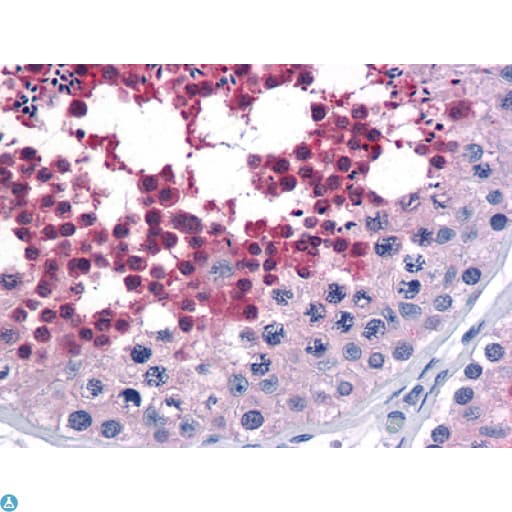 Monoclonal Mouse anti-Human CDC25C Antibody (IHC, WB)