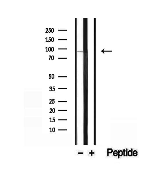 EXOC3 / SEC6 Antibody