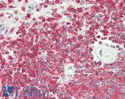 IHC-plus™ CLK4 Antibody (70-150 aa, Internal)