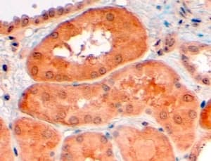 PCSK9 Antibody (aa679-692)