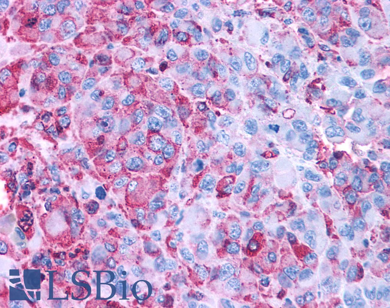 PathPlus™ GPR50 Antibody (C-Terminus)