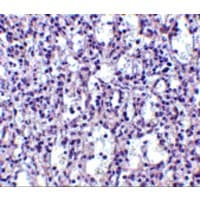TBC1D10C / CARABIN Antibody