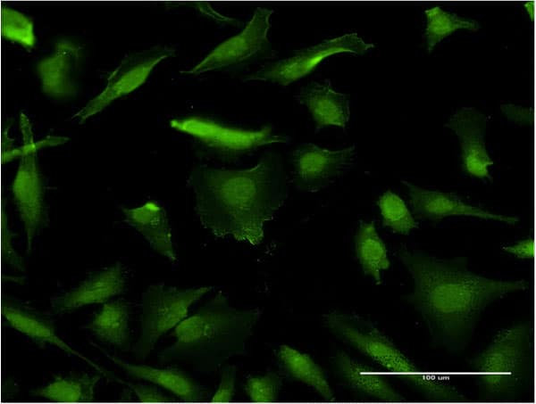 Monoclonal Mouse anti-Human HMGIY / HMGA1 Antibody (clone 2A1, IF, WB)