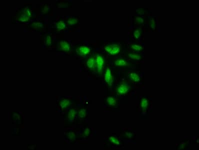 MAPKAPK5 / PRAK Antibody