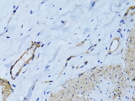 Polyclonal Rabbit anti-Human MCAM / CD146 Antibody (IHC, WB)