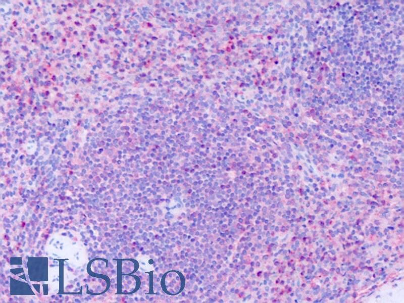 IHC-plus™ Polyclonal Rabbit anti-Human GPR63 Antibody (Extracellular Domain, IHC)