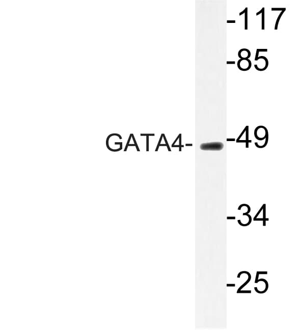 GATA4 Antibody (Gln258)