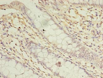 ASB8 Antibody