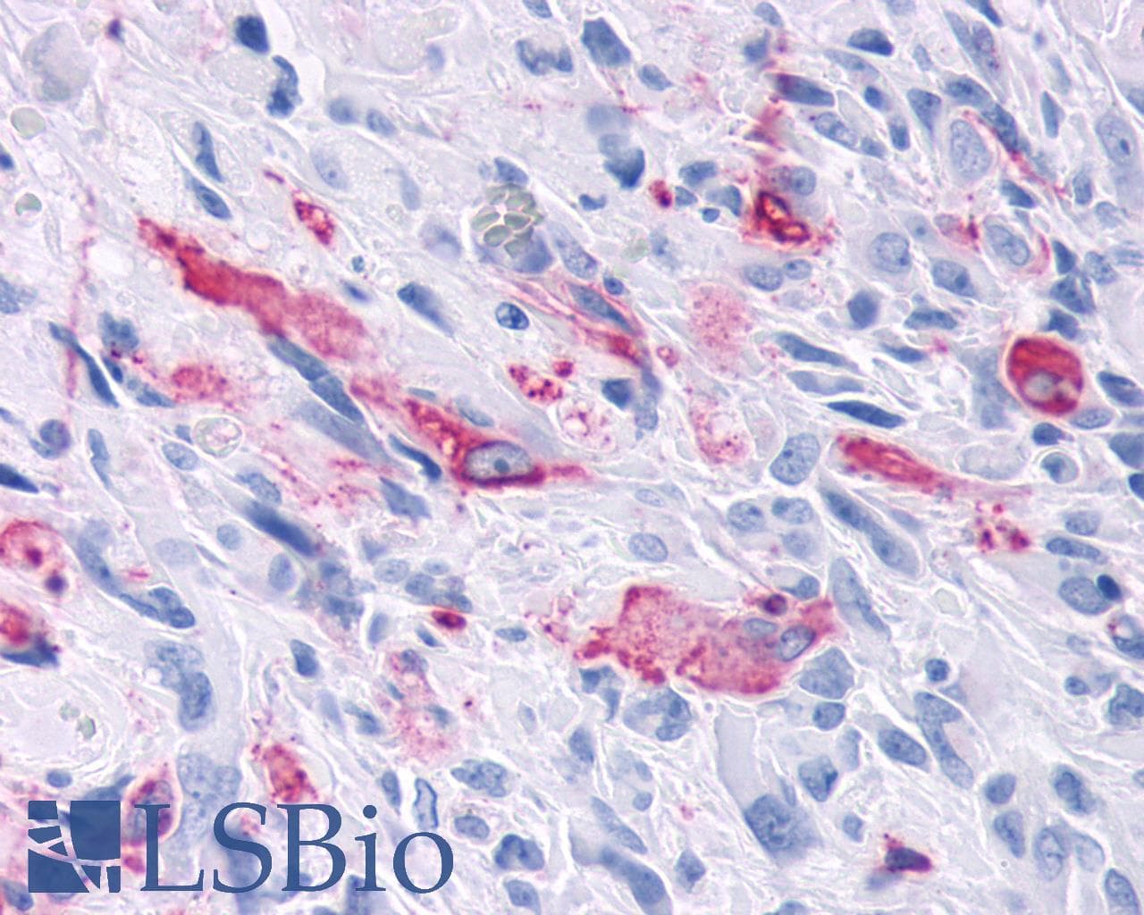 PathPlus™ MRGD / MRGPRD Antibody (Cytoplasmic Domain)