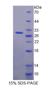 Human SCO2 Protein (Recombinant His-T7)