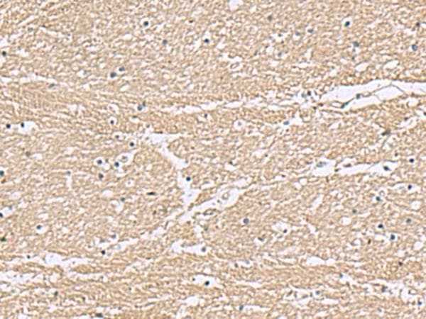 Polyclonal Rabbit anti-Human KCTD7 Antibody (IHC, WB)