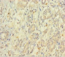 EIF5 Antibody (aa1-431)