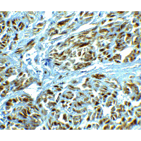 Polyclonal Rabbit anti-Human LRRC26 Antibody (IHC, IF, WB)