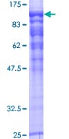 Human RAP1GAP Protein (Recombinant GST)