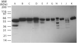 IHC-plus™ Polyclonal Rabbit anti-Human RNF216 / TRIAD3 Antibody (aa350-400, IHC, WB)