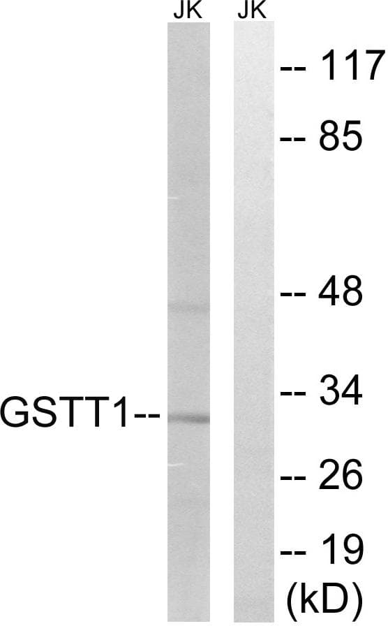 GSTT1+4 Antibody