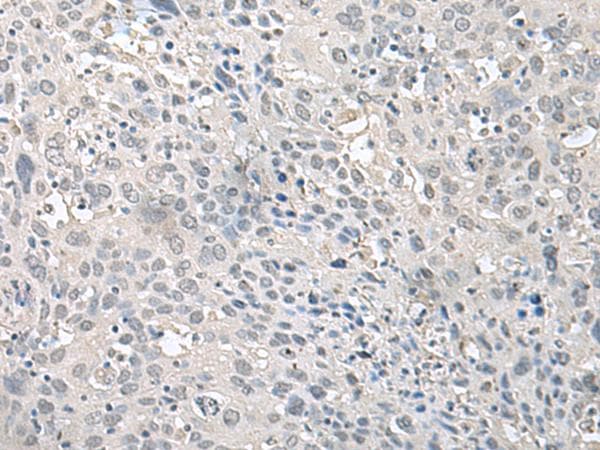 EPM2A / Laforin Antibody