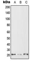 Polyclonal Rabbit anti-Human RAC2 Antibody (C-Terminus, WB)