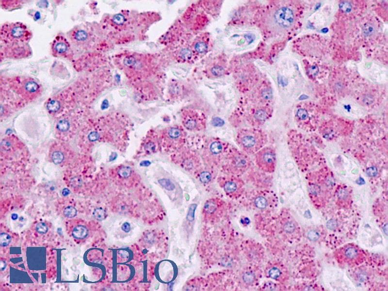IHC-plus™ CYP21A2 Antibody (aa151-200)