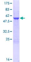 Human METAP1 Protein (Recombinant GST)