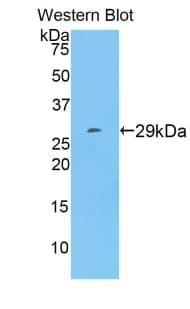 GPT / Alanine Transaminase Antibody (aa203-443)
